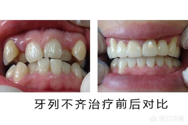 衢州最新24小时牙医在线咨询方法分析(最方便真实的衢州有没有24小时牙医方法)