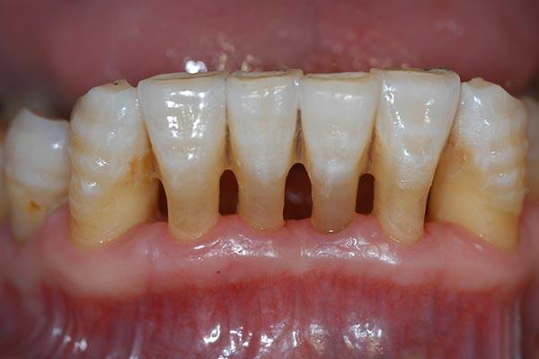 衢州最新24小时牙医在线咨询方法分析(最方便真实的衢州有没有24小时牙医方法)